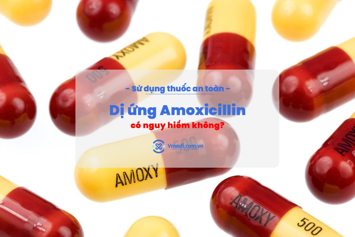 di-ung-amoxicillin
